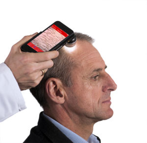 FotoFinder handyscope for iPhone 6 (2)