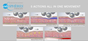 actions
